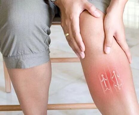 Дисфункция на венозния кръвен поток в долния крайник