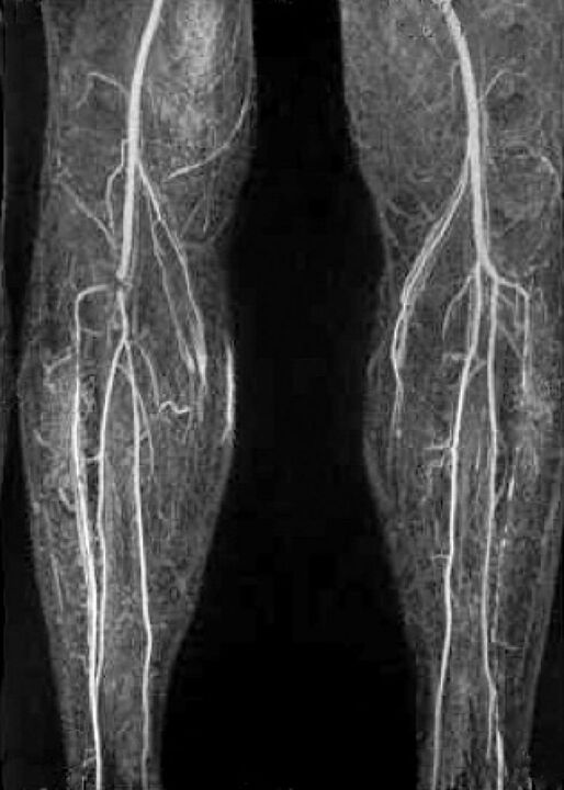 Съдова x -ray