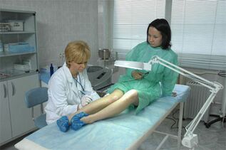 Лазерна терапия при разширени вени на краката