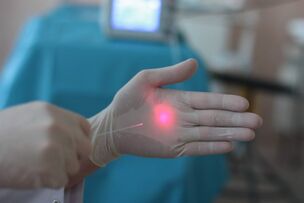 как да се подготвим за лазерно лечение на разширени вени